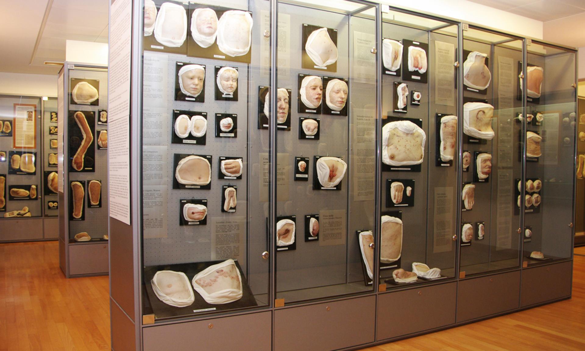Le vetrine nel Moulagenmuseum dell'università e dell'ospedale universitario di Zurigo